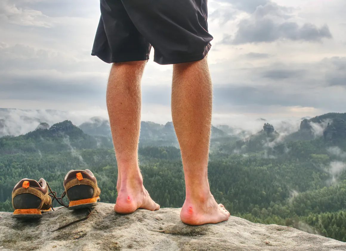 Close-Up-On-Blister-On-Foot-Of-A-Male-scaled-1